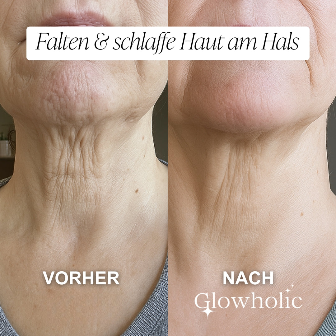 Glowholic Sommer Anti-Falten Starter Set - Micro-Needling-Infusion
