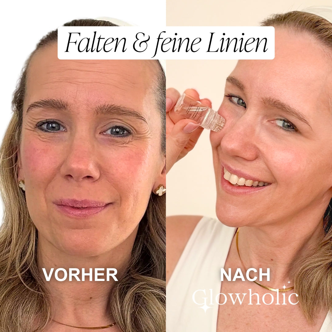 Glowholic Sommer Anti-Falten Starter Set - Micro-Needling-Infusion