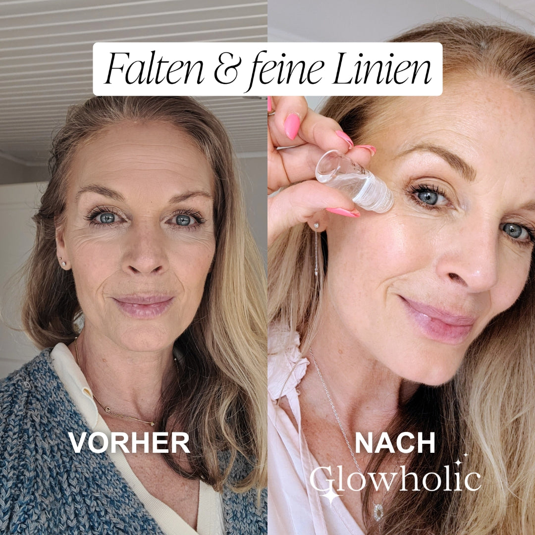 Glowholic Sommer Anti-Falten Starter Set - Micro-Needling-Infusion