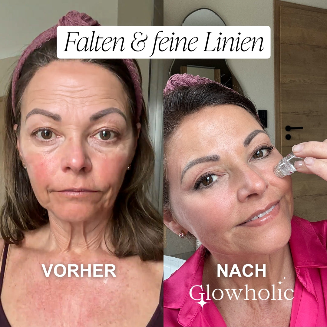 Glowholic Sommer Anti-Falten Starter Set - Micro-Needling-Infusion